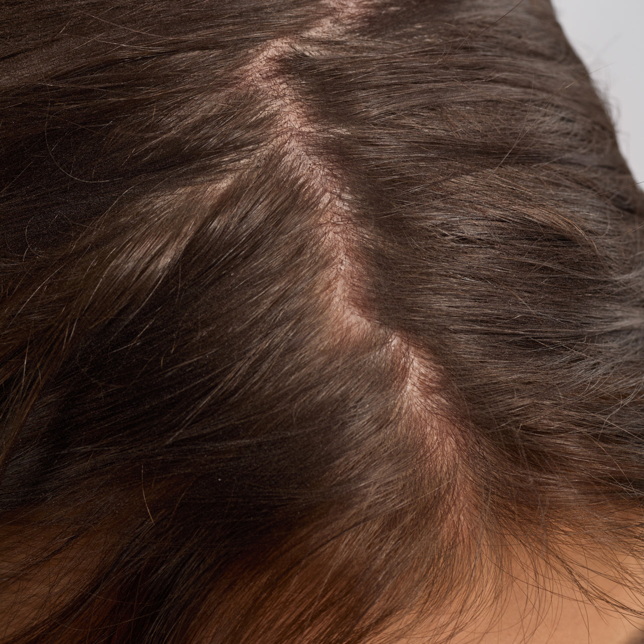 KITSCH Strengthening Rosemary & Biotin Scalp & Hair Oil 2fl oz./60mL — before shot of model hair — 100% plant-based oil formulated with rosemary extract and biotin — works on all hair types to loosen buildup and nourish the scalp
